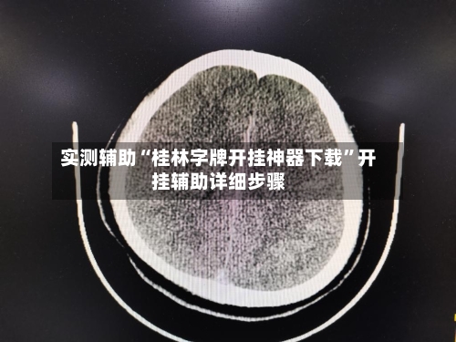 实测辅助“桂林字牌开挂神器下载”开挂辅助详细步骤-第2张图片