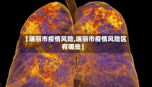 【瑞丽市疫情风险,瑞丽市疫情风险区有哪些】