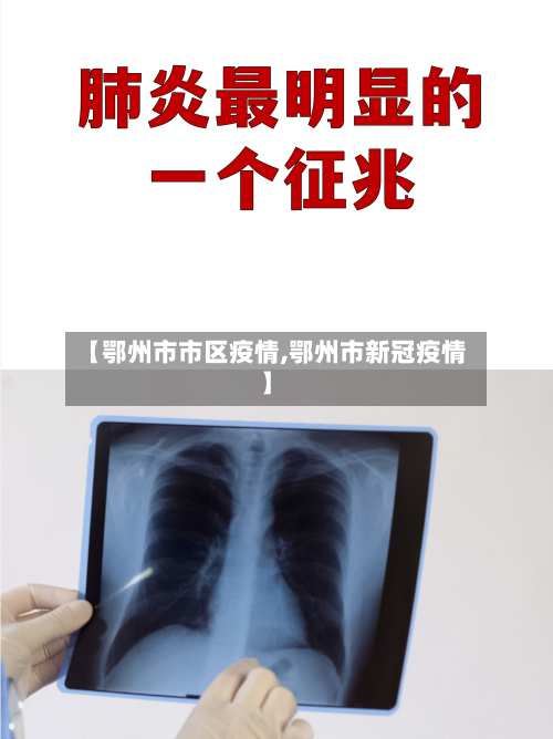 【鄂州市市区疫情,鄂州市新冠疫情】-第3张图片