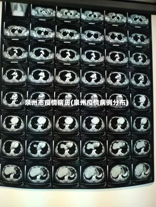 泉州市疫情病历(泉州疫情病例分布)-第3张图片